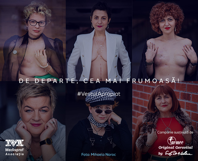 de departe cea mai frumoasa